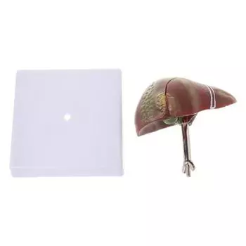 Патологическая анатомическая модель печени человека, анатомическая школа, медицинский обучающий инструмент, лабораторное оборудование