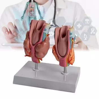 Патологическая анатомическая модель щитовидной железы со съемными частями Патологическая анатомическая модель щитовидной железы и гортани для изучения заболеваний