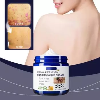 Пчела, Пчелиная мазь, Пчела, облегчает покраснение и зуд кожи на руках и ногах для