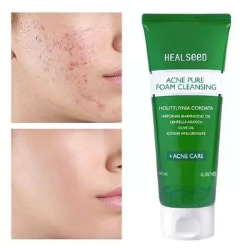 Пенка очищающая Yakmomil Hillseed Acne Pure Foam Cleansing 150 мл, отправлено из главного офиса, 1 шт.