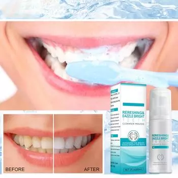 Пенная зубная паста для ухода за полостью рта 1 упаковка Ремонт и защита зубов Профилактика кариеса 60 мл Антиналет и отбеливание Отбеливание зубов 60ML