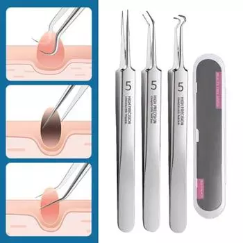 Пинцет для удаления черных точек, инструмент для удаления угрей из нержавеющей стали, нескользящая ручка, набор для удаления черных точек и угрей 1 Set
