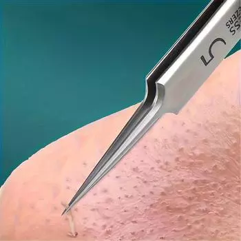 Пинцет для удаления угрей с ультратонкими клетками, пинцет для салонов красоты, игла для удаления угрей, инструмент для глубокой очистки кожи лица с зажимом 1PC
