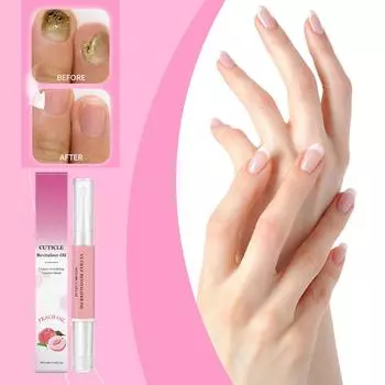 Питательный и растрескивающийся лак для ногтей, прочная поверхность ногтей, уменьшает ломкость, стойкий, блестящий, мягкий и не повреждает ногти, подходит для ежедневного использования.3 мл One Size белый