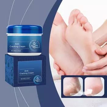 Питательный крем для ног Увлажняющий и увлажняющий крем для ног от сухости и питания