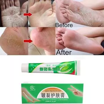 Питательный крем против растрескивания, лечение запаха, средства по уходу за кожей, средство для удаления омертвевшей кожи, восстанавливающий крем для потрескавшейся кожи