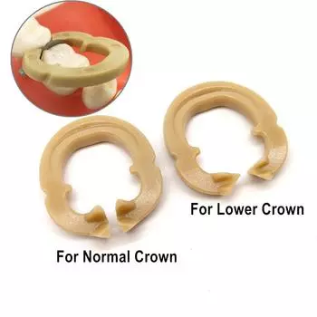 Пластмассовые зажимы для стоматологических зажимов Разделительное кольцо Секционные контурные держатели матриц Фиксированный зажим матрицы Автоклавируемый 134°C 2 pieces for normal crown