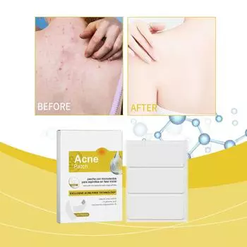 Пластырь от прыщей на спине Мягко очищает кожу от прыщей на спине и плечах, делая ее гладкой, увлажненной, восстановленной и дышащей One Size