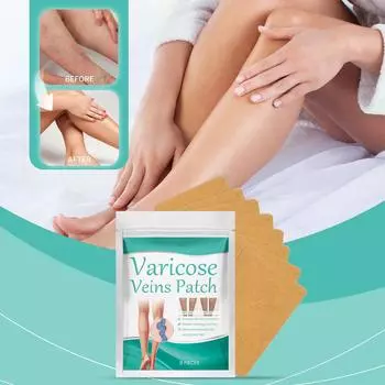 Пластырь от варикозного расширения вен Hirudin, васкулит, флебит, сосудистый отек, лучшее средство, мазь, пластырь для ухода за кожей 10 шт. One Size белый