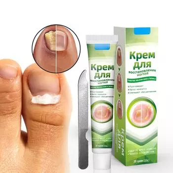 Пластырь, серый крем для ногтей, новый яркий калиевый крем для ногтей, с пилочкой
