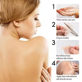 Пластыри для шрамов, удаляющие силиконовые гелевые листы, лечебные пластыри, корректоры для ушей, ожоговые раны, эффективная хирургическая лента для шрамов, ремонт кожи 4*15cm (1 piece)