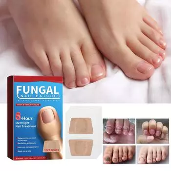 Пластыри для ухода за ночными ногтями Пластыри для ухода за ногтями Пластыри для ухода за утолщенными ногтями Вросшие ногти и мягкие ногти Пластыри для ухода за ногтями One Size