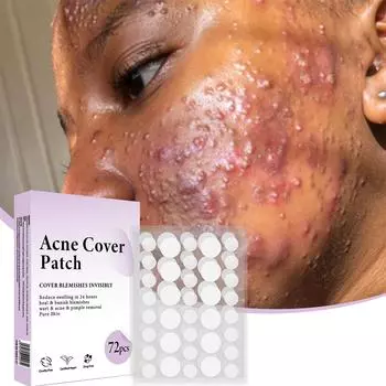 Пластыри от прыщей для лица, пластыри от прыщей, 3 размера, круглые крышки, гиалуроновая кислая кожа, симпатичные чехлы от прыщей (72 Графа)