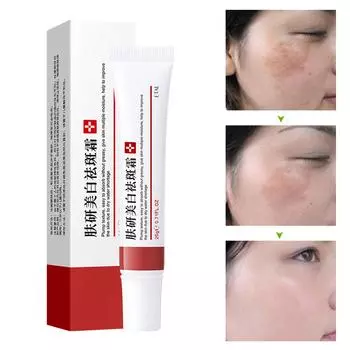 Полезный осветляющий крем против акне многофункциональный глубоко питательный корректор темных пятен осветляющий крем 20g