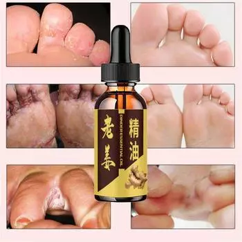 Попрощайтесь с запахом ног и бери-бери с помощью нашего крема для ног с эфирными маслами 5ml