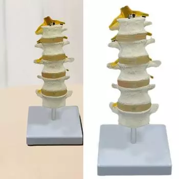 Пятисегментная модель поясничного отдела позвоночника. Анатомическая модель поясничного отдела позвоночника человека. Патологическая анатомическая модель поясничного отдела позвоночника для исследований.