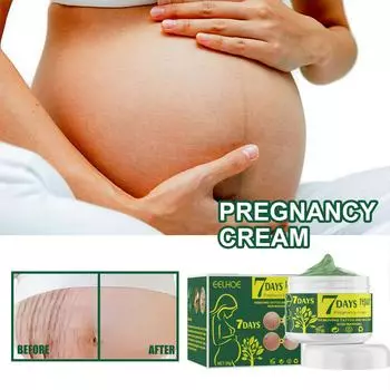 Предотвращение растяжек Предотвращение и исчезновение растяжек Удаление шрамов от растяжек Растяжки для мамочек и матерей зелёный