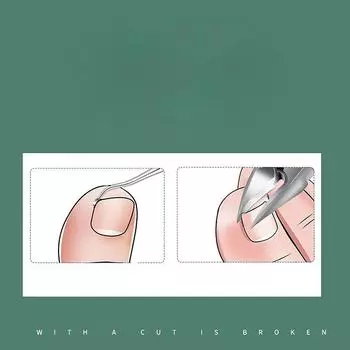 Профессиональные кусачки для ногтей на ногах, резак для вросших ногтей, инструмент для удаления толстых ногтей, омертвевшей кожи, супер острые изогнутые лезвия, инструменты для ногтей красный