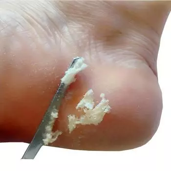 Профессиональный инструмент для удаления мозолей на ногах - пилка для ног из нержавеющей стали для удаления омертвевшей кожи и мозолей - прочный скребок для педикюра для домашнего использования - легко 1pc