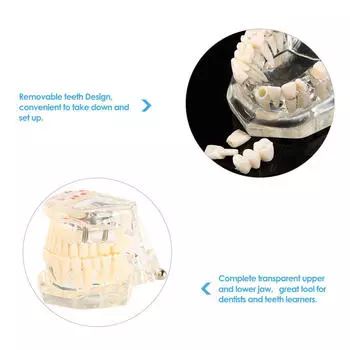 Прозрачная зубная имплантация, модель зубов, обучающий инструмент для зубов, стоматологический типодонт для взрослых