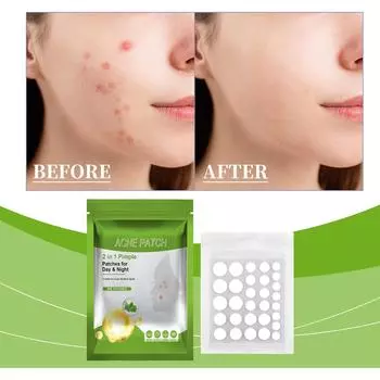 Прозрачный пластырь от прыщей, гелевый пластырь от прыщей на водной основе, противовоспалительный, от красных и опухших прыщей