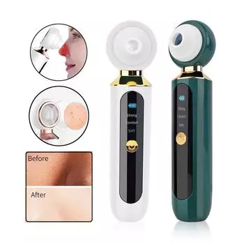 Пылесос для удаления черных точек, очиститель пор, чистка лица, всасывание черных точек, отшелушивающий инструмент для удаления прыщей и прыщей, уход за кожей USB recharge белый