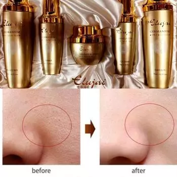 Regenerative lifting basic set / small wrinkles, age spots, dark spots, nasolabial folds zero, 1 box, 1 piece