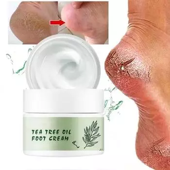 Ремонт парней, пилинг трещин, уход за ногами, уход за ногами, увлажняющий крем для ухода за ногами против замерзания складок, чайное дерево 5G