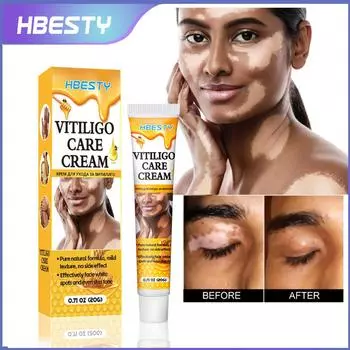 Revitalizing White Spot Cream With Bee Venom For Effective Body Care Solutions