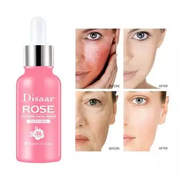 Rose Essence Увлажняющая, успокаивающая и смягчающая эссенция Эссенция Rose Serum 30ml