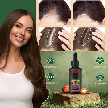 Рост волос способствует росту волос, способствует густым волосам для мужчин и женщин Масло для роста волос, 60 мл One Size