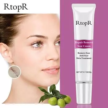 RtopR крем для удаления шрамов от прыщей, растяжек, крем для восстановления кожи, крем для лица, пятна от прыщей, лечение прыщей, отбеливающий крем для угрей, уход за кожей
