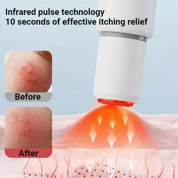 Ручка против зуда от укуса комара, портативное устройство для обогрева и успокоения кожи, электрическое устройство против зуда, инфракрасная импульсная палочка для зуда