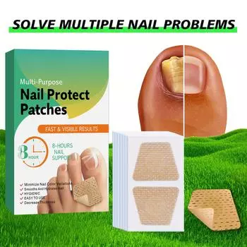 Руки и ноги Мягкие ногти Инкрустированные ногти Утолщение Яркие борозды для ногтей Серые патчи для ухода за ногтями