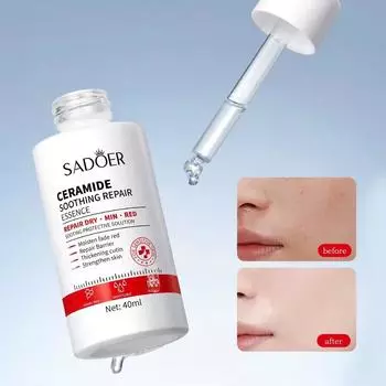 SADOER Ceramide Успокаивающая эссенция Сыворотка для лица Увлажняющая Восстановление Сухость Покраснение Увлажнение Многократное восстановление лица Питательный уход за кожей