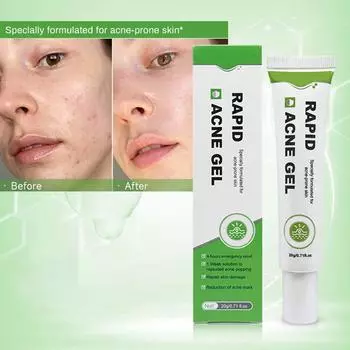 Салициловый гель для удаления прыщей - контролирует жирность кожи лица и - осветляет прыщи - способствует метаболизму кожи 20 г зелёный