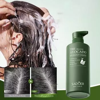 Шампунь против перхоти и контроля жирности волос с авокадо, 500 мл. Мягкий, увлажняющий, освежающий, гладкий, питательный, пушистый, очищающий и борющийся с перхотью. 500ml