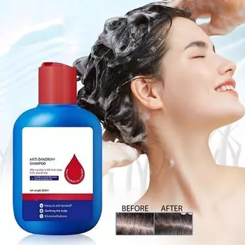 Шампунь, Шампунь с сульфидом селена, Шампунь для контроля жирности, уменьшает излишнюю жирность, мужской и женский, освежающий, 120 мл One Size синий