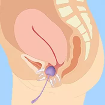 Шарики Кегеля 5 Женские Дамские Вишневые Шарики Кегеля Скрученные Плотные с Утяжеленными Яйцами Стимуляция Точки G Улучшающие Телосложение Секс Игрушки 5pcs