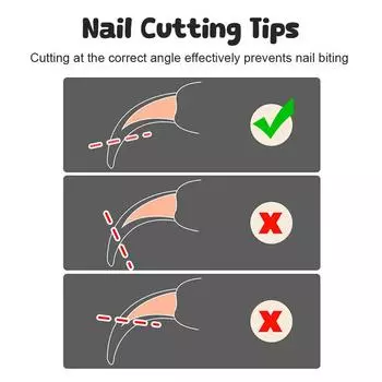 Щипчики для кошачьих когтей Избегайте чрезмерного срезания Кусачки для когтей домашних животных Безопасный профессиональный триммер для лап домашних животных Триммер для ухода за когтями домашних животных Товары для животных