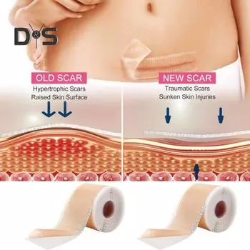 Силиконовые пластыри для рубцов, рулон ленты для рубцов, профессиональные мягкие полоски для рубцов после хирургических операций, келоидные рубцы, лечение угревой сыпи, силиконовый гелевый пластырь 150CM чистый