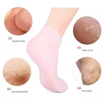 Силиконовые увлажняющие спа-гелевые носки на пятке, отшелушивающие и предотвращающие сухость потрескавшейся омертвевшей кожи, удаляют протектор, инструменты для облегчения боли 35-40 белый