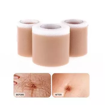 Силиконовый гель пластырь для лечения шрамов удаление пластыря покрытие ожог травма ремонт акне шрам от ушей раздел красота кожи