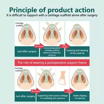 Силиконовый корректор для носа, корректор для переносицы, корректирующий зажим для носа, корректор для выпрямления переносицы, массажный инструмент XS