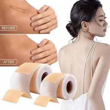 Силиконовый пластырь для шрамов Nude Scar Tape Roll Scar Sheet Removal Self-Adhesive Tape Therapy Patch Burn Acne Surgical Scar Skincare S