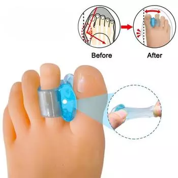 Силиконовый разделитель пальцев ног, корректор вальгусной деформации большого пальца стопы, ортопедические принадлежности, выпрямитель для большого пальца стопы, средства по уходу за ногами 10pcs прозрачный