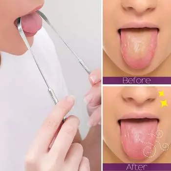 Скребок для чистки языка для взрослых, хирургический класс для устранения неприятного запаха изо рта, металлическая щетка для чистки языка из нержавеющей стали, стоматологический набор 1PC GS01