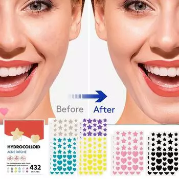 Смешанный цвет Большой объем Звезда Акне Пластырь Мягкий Не раздражает Осветляет Акне Акне Закрытый рот Улучшает Акне Мышечный Гидроколлоид красный