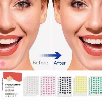 Смешанный цвет Большой объем Звезда Акне Пластырь Мягкий Не раздражает Осветляет Акне Акне Закрытый рот Улучшает Акне Мышечный Гидроколлоид белый