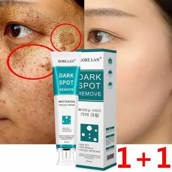 SMIATEY 1+1 Крем для удаления пигментных пятен Vita e Whitening Cream Cream Age Spot Blemishes 20 мл 1 шт., 2 контейнера, 20 г
